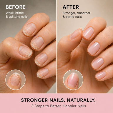 Before and after nail results showing weak brittle splitting nails improved to stronger smoother natural nails with a 3-step nail strengthening routine