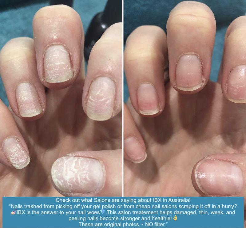 How To Strengthen Weak Nails Quickly